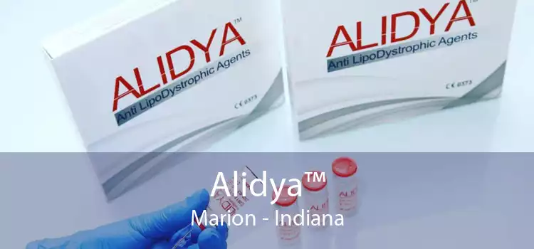 Alidya™ Marion - Indiana