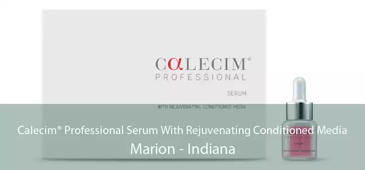 Calecim® Professional Serum With Rejuvenating Conditioned Media Marion - Indiana