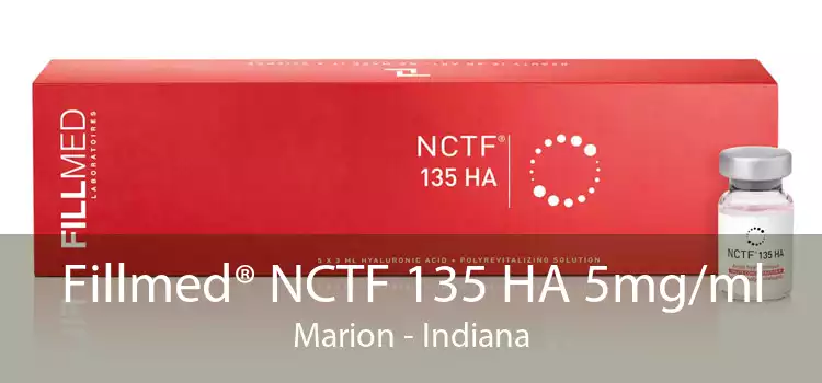 Fillmed® NCTF 135 HA 5mg/ml Marion - Indiana