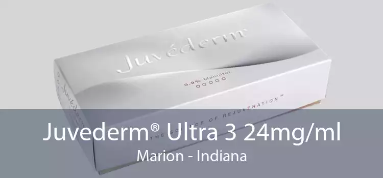 Juvederm® Ultra 3 24mg/ml Marion - Indiana